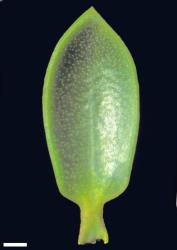 Veronica mooreae. A leaf with stomata on the adaxial surface, a feature common only near Denniston and Caswell Sound. Scale = 1 mm.
 Image: W.M. Malcolm © Te Papa CC-BY-NC 3.0 NZ